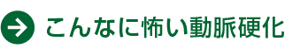 こんなに怖い動脈硬化